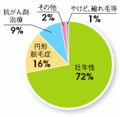 かつら作製理由