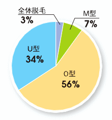 かつら作製理由