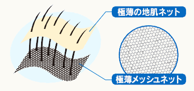 特殊レイヤー構造